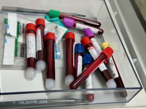 A blood sample in a laboratory